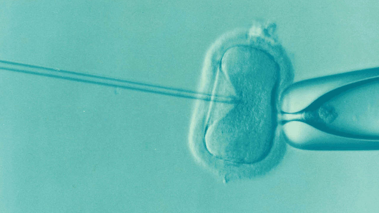Microscopic image of uvf