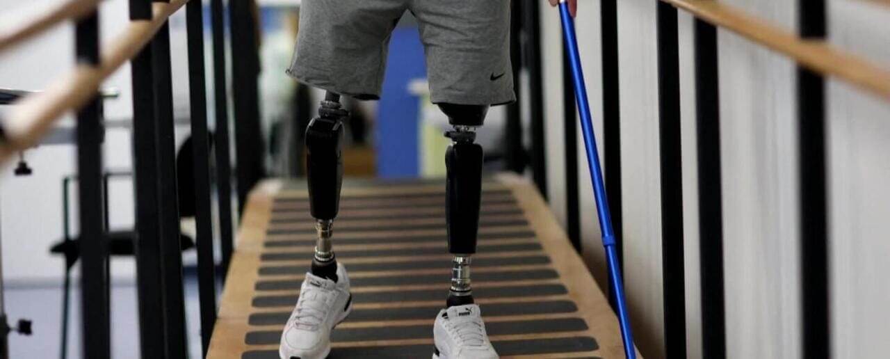 man with prosthetic limbs walking down steps