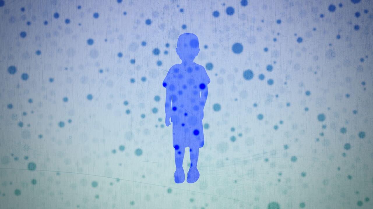 Shadow of a child surrounded by blue dots representing measles