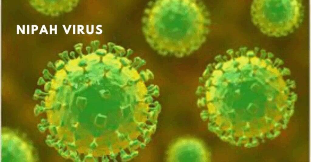 Nipah virus