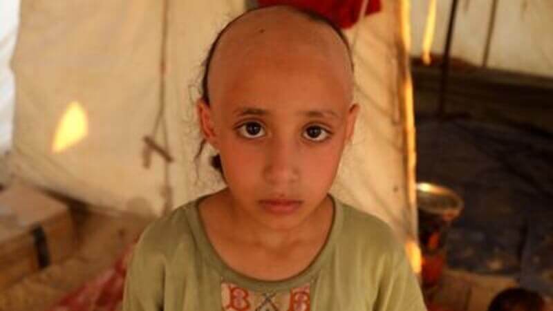 palestinian girl hair fell out Video cover of gaza child who lost her hair from the stress of war refuseniks refuse to kill more children