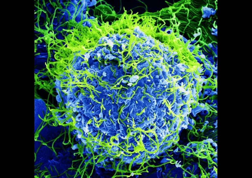 Magnified view of the ebola virus