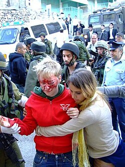 Next image from the featured image’s series of the boy’s injuries